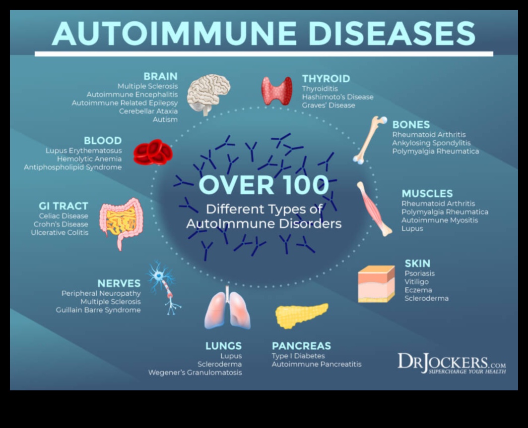 קטונים - טיפול פוטנציאלי למחלות אוטואימוניות 4 תפקידם של קטונים בניהול מצבים אוטואימוניים